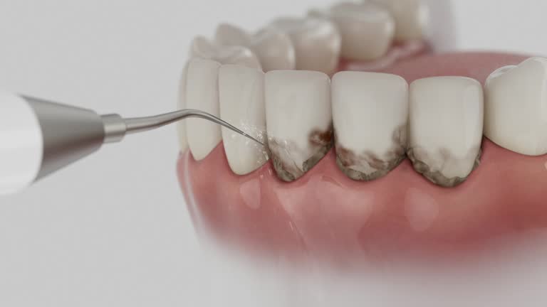 Reliable Teeth Whitening contractor in Baraga County County, MI by Dentist Open Now